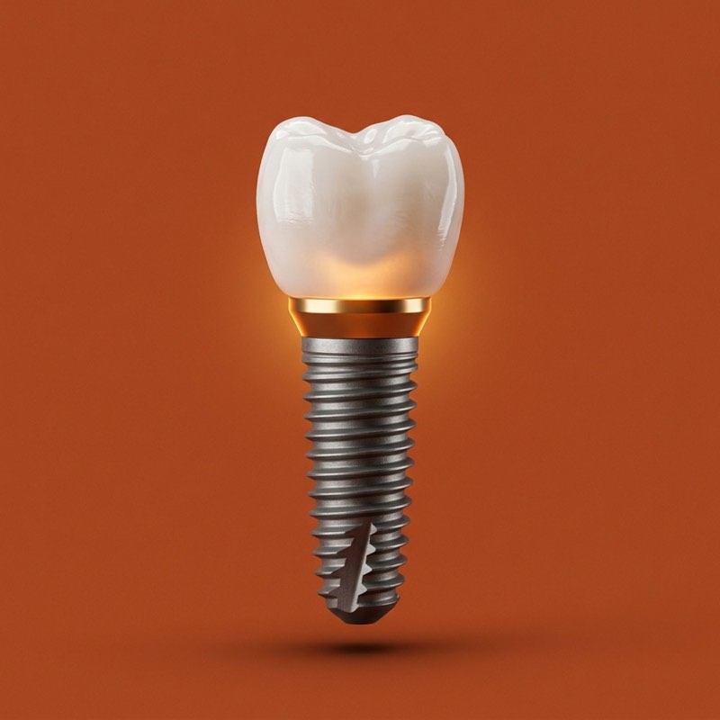 Modern 3D Dental Implant